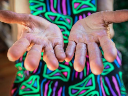 person opening palms close up photo